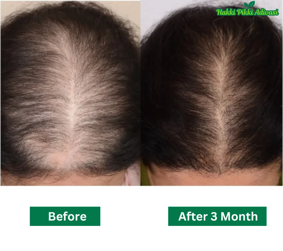 adivasi-hair-oil-before-after.