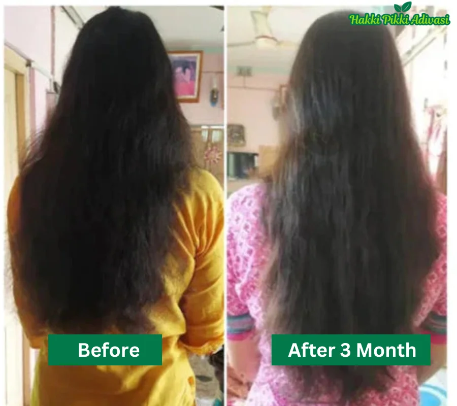 hakki-pikki-aadivasi-hair-oil-before-after.