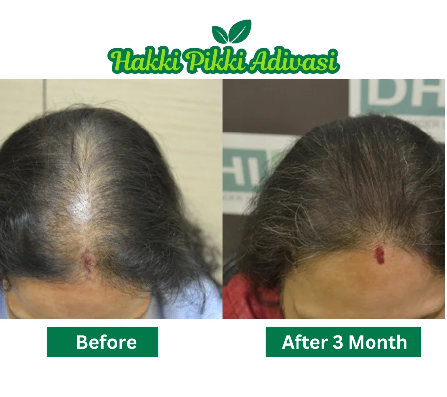 original-adivasi-hair-oil-before-after.